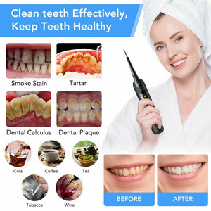 USB Rechargeable Electric Dental Calculus Tooth Cleaner with LED HD Screen