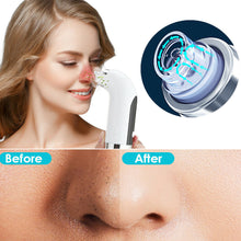 Rechargeable Electric Pore Blackhead Vacuum Cleaner